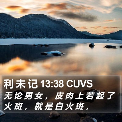 利 未 记 13:38 CUVS Bible Verse Image