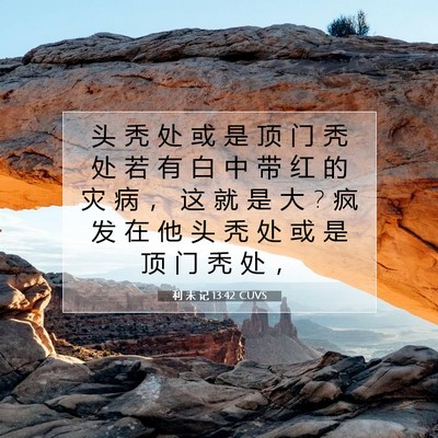 Picture 07 - 利 未 记 13:42 CUVS - 头 秃 处 或 是 顶 门 秃 处 若 有 白 - Bible Verse Picture